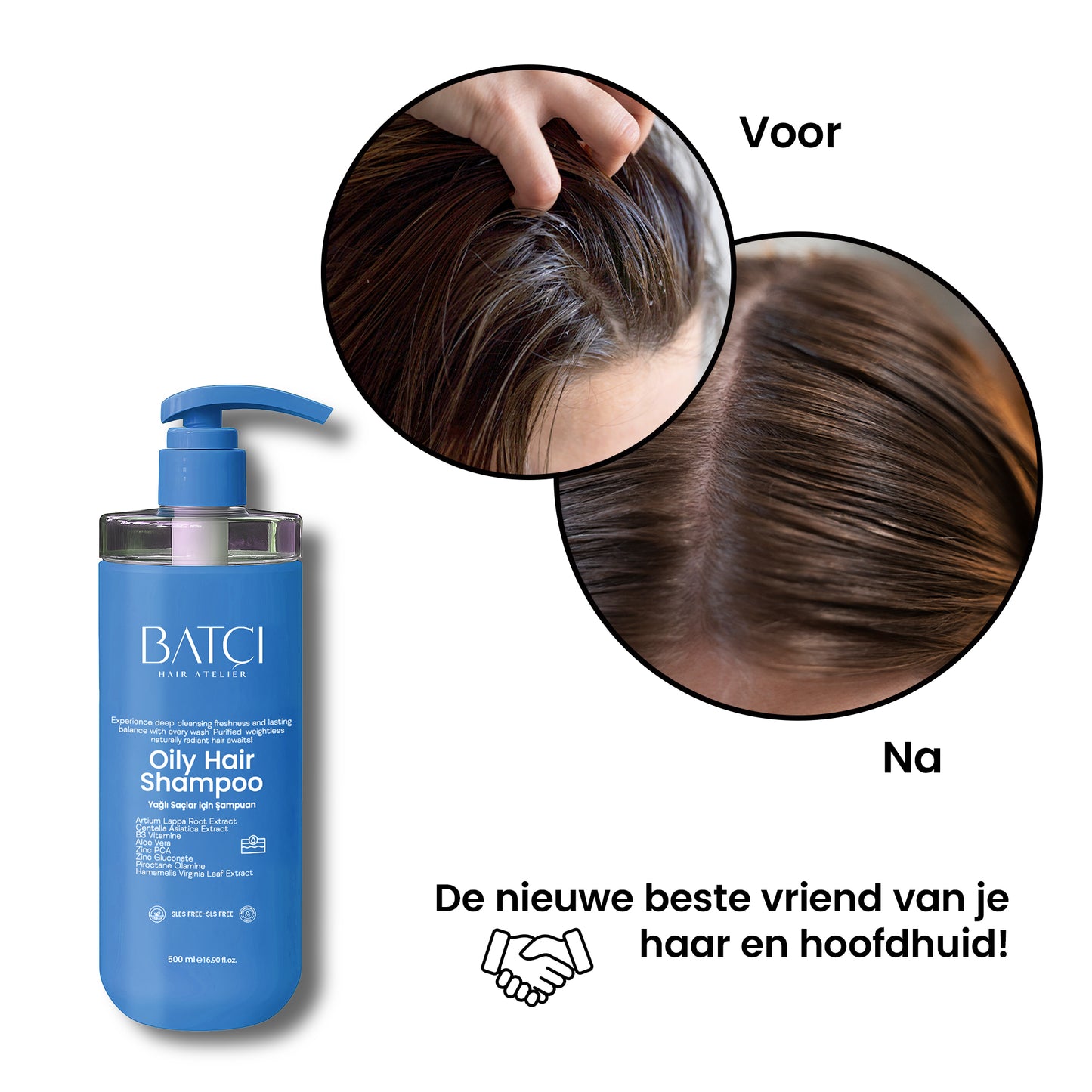 Anti-Grease Shampoo 500 ml 