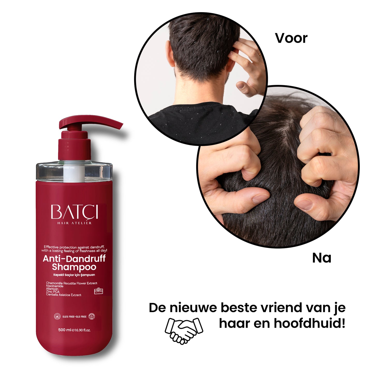 Anti-Dandruff Shampoo 500 ml 