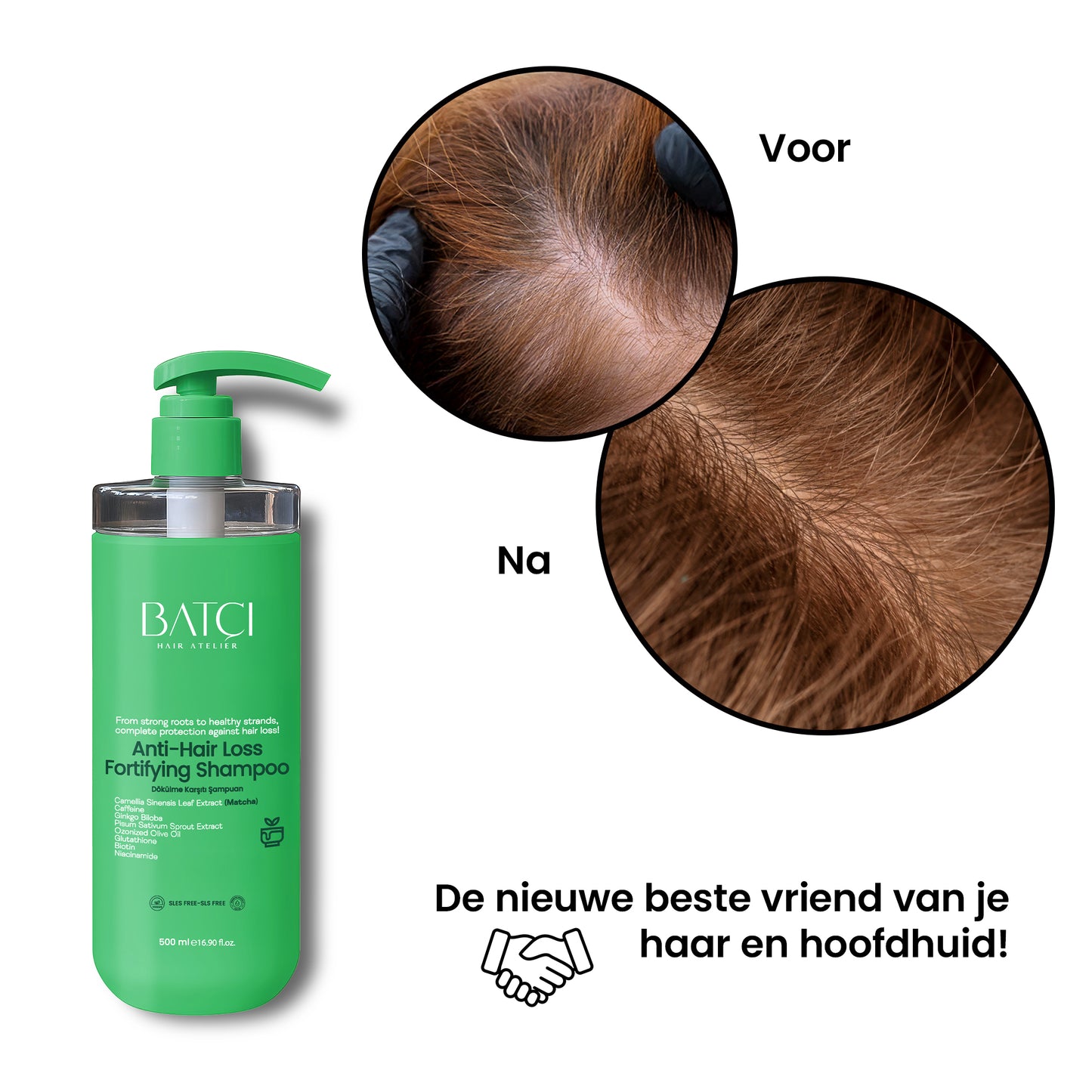 Anti-Hair Loss Shampoo 500 ml – Volumizing and Nourishing Formula with Ginkgo Biloba and Glutathione